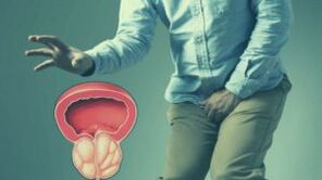Acute prostatitis